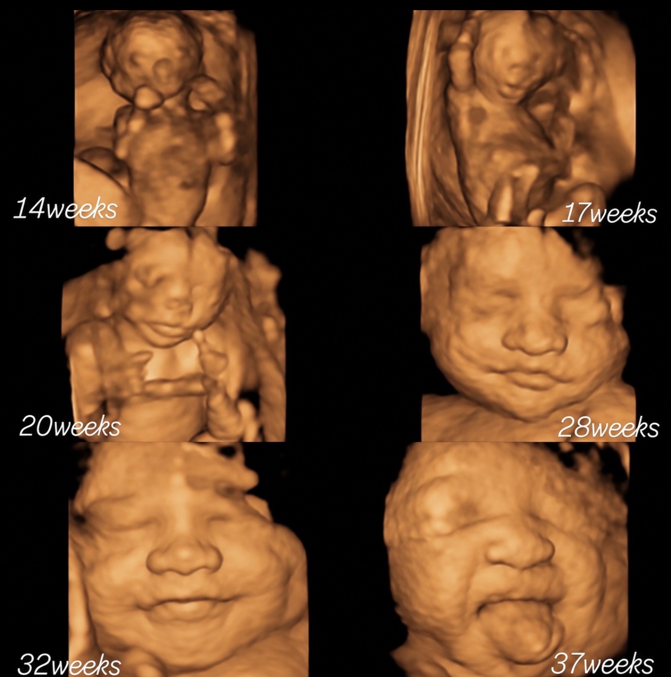 Supplied ultrasound image collage labeled at different pregnancy stages